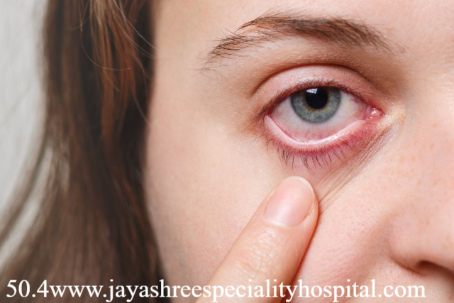 Ciri Mata Silinder yang Ganggu Penglihatan